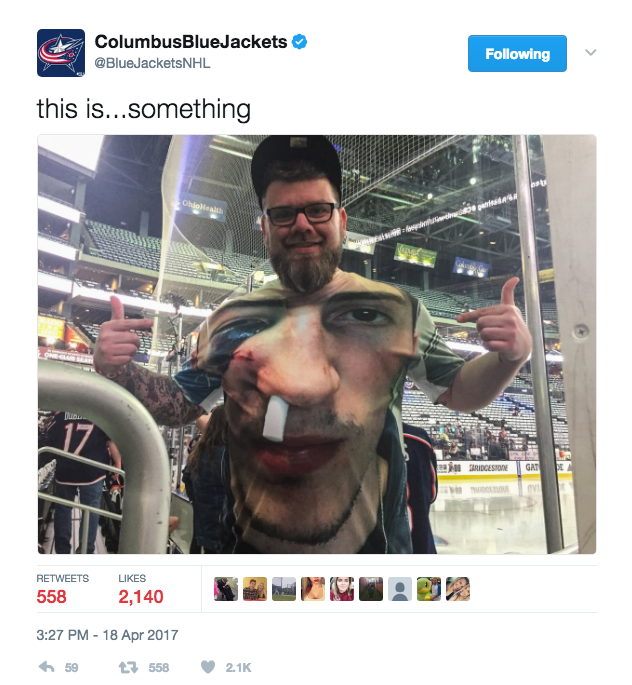 Fan who wears shirt of Zach Werenski's jacked-up face gets signed
